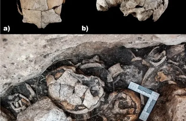 Шокирующая находка: 5300-летний череп и первая операция на ухе!