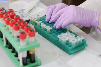 Ученые нашли способ выявления рака за годы до диагноза — потрясающая революция в медицине!